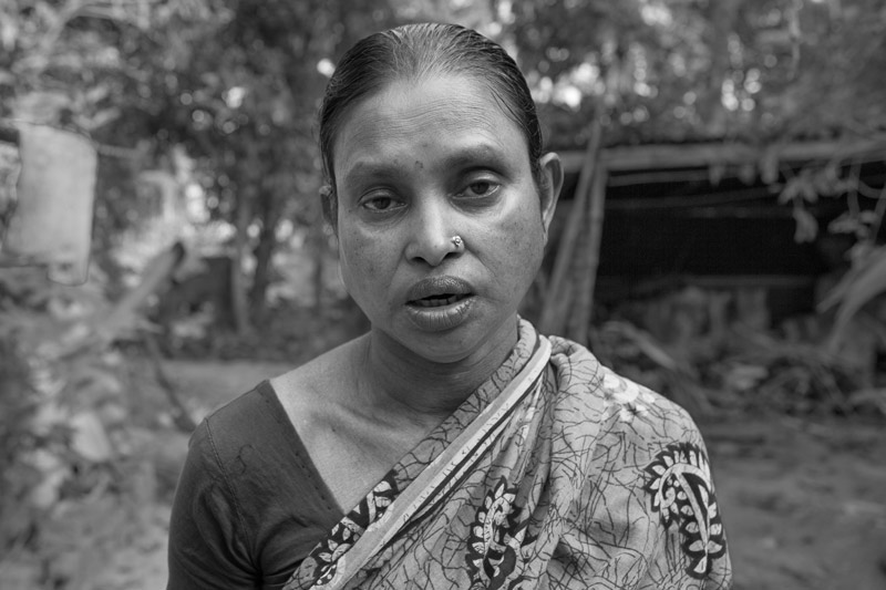 Nomita Biswas, 43 years, an arsenicosis patient from neighboring Teghoria village, explaining how consumption of packaged drinking water from the pond in village Madhusudankati, North 24 parganas district, West Bengal, is helping her recover from the symptoms